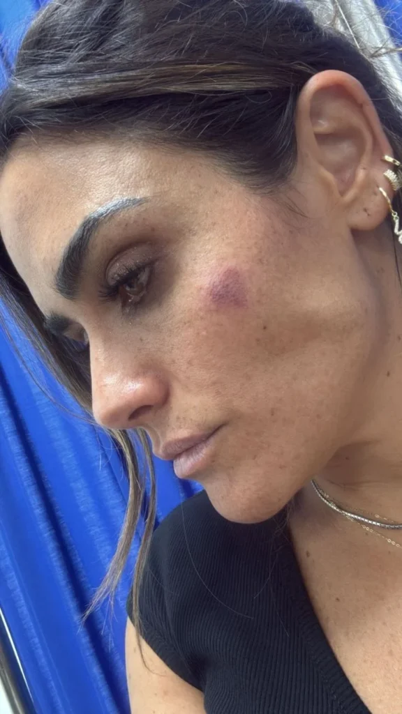 Alessandra Rojo de la Vega es agredida por comerciantes en las inmediaciones del Metro San Cosme